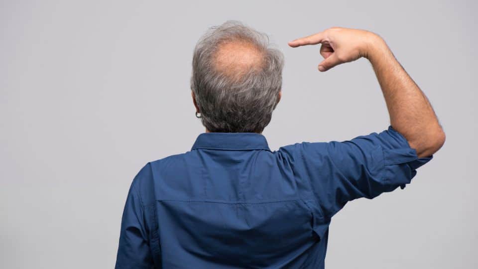 האם סטרס מתינוק חדש יכול לגרום להתקרחות גברית?