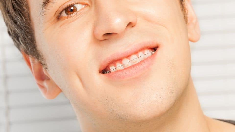 4 שיטות לישור שיניים