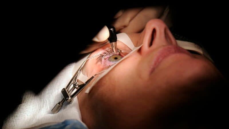 אופן ביצוע הניתוח