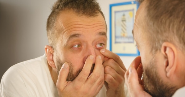 פצעון בפניו של הגבר